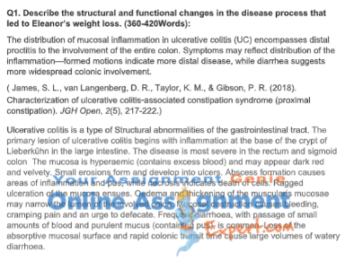 ulcerative colitis case study sample